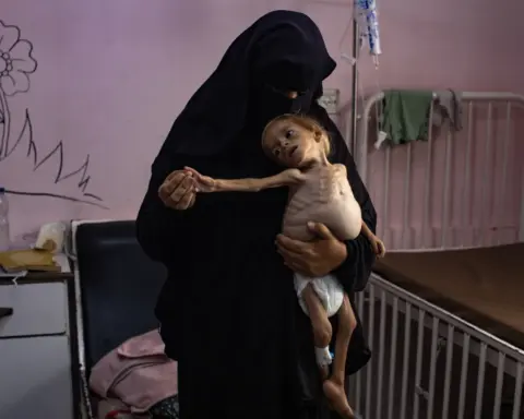 Palestinian child Sham Qudeih amid the famine spreading across Gaza. EPA/HAITHAM IMAD