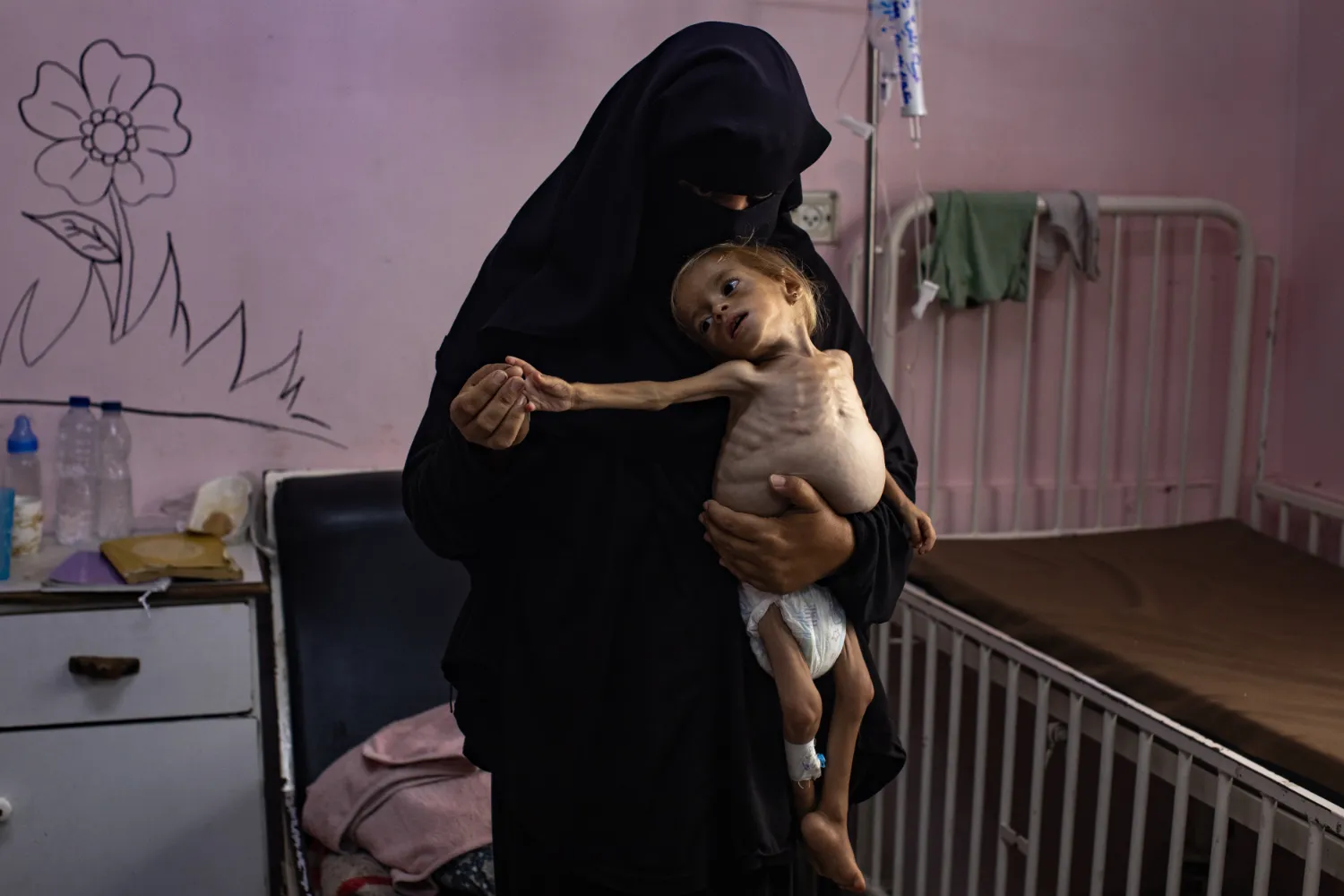 Palestinian child Sham Qudeih amid the famine spreading across Gaza. EPA/HAITHAM IMAD